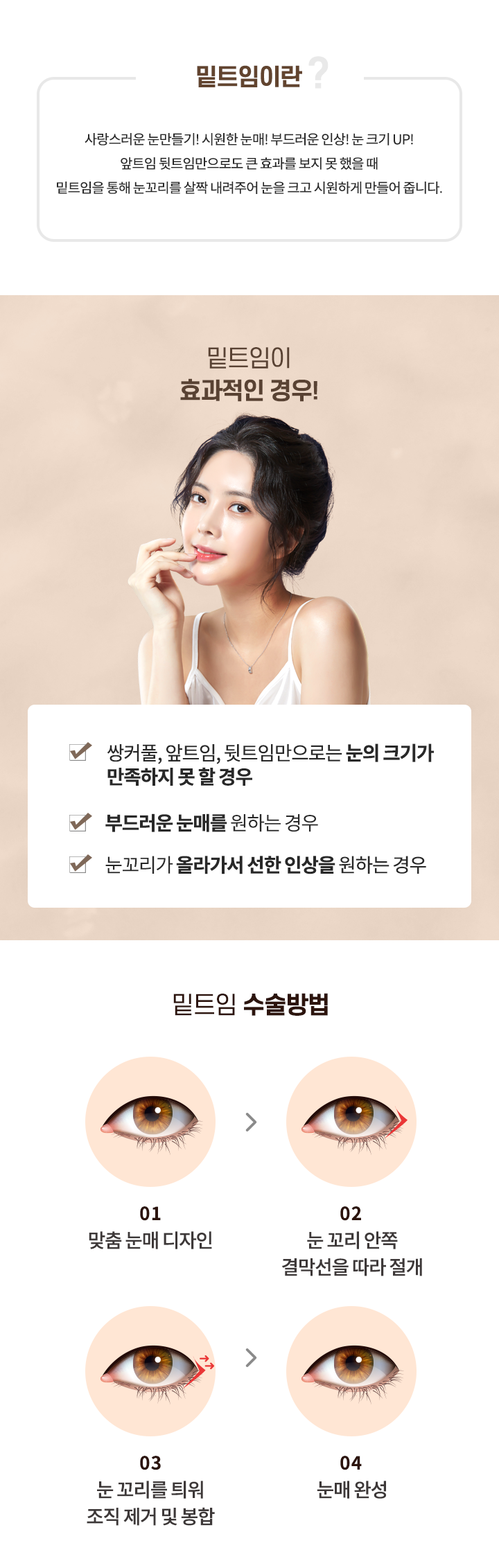 밑트임이란