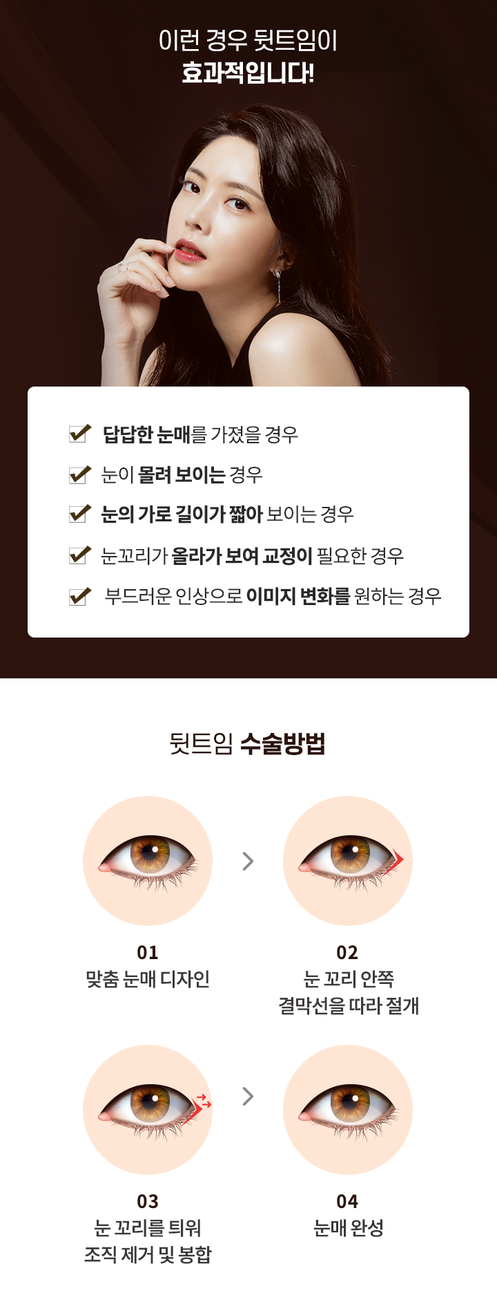 뒷트임 수술방법