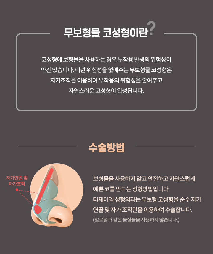 에스탑 무보형물코성형이란?, 수술방법