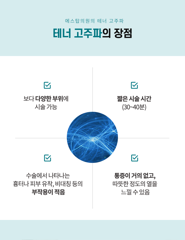 장점