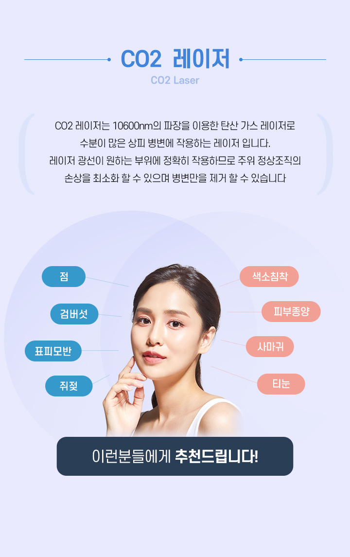 CO2레이저