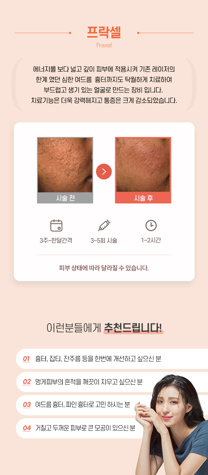 프락셀